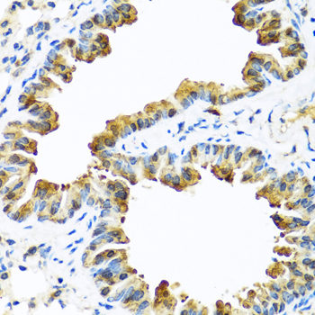SERPINA10 Polyclonal Antibody