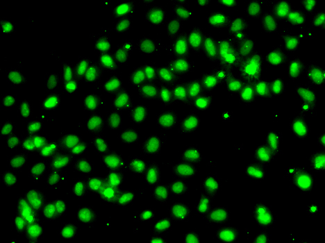 MEPCE Polyclonal Antibody
