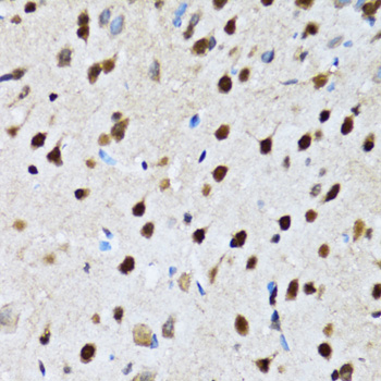 CCAR2 Polyclonal Antibody