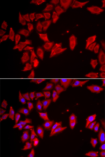 SLC35A2 Polyclonal Antibody