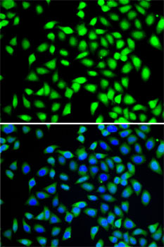 [KO Validated] SGTA Polyclonal Antibody