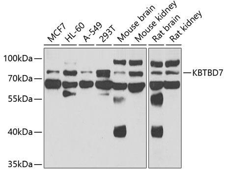 KBTBD7 Polyclonal Antibody