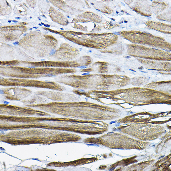 LDB3 Polyclonal Antibody