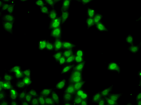 HDGFRP2 Polyclonal Antibody