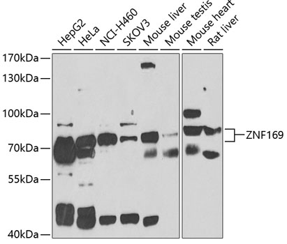 ZNF169 Polyclonal Antibody