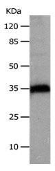 CTSZ Antibody