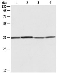 RPLP0 Antibody