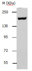 ACE1 Antibody