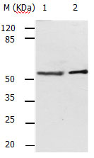 ACVR2A Antibody