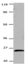 CSNK2B Antibody