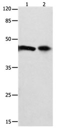 FOXL1 Antibody