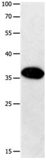 GPR6 Antibody