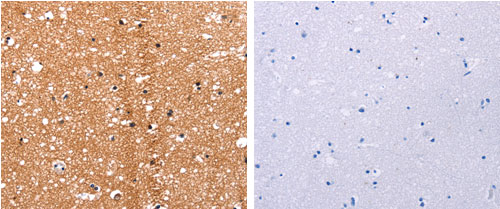 HDAC7 Antibody