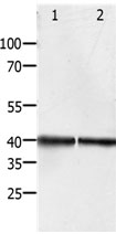 PDX1 Antibody