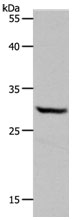 NQO1 Antibody