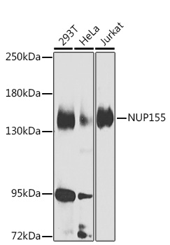 NUP155 Polyclonal Antibody
