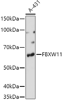 FBXW11 Polyclonal Antibody