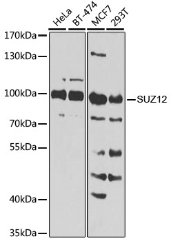 [KO Validated] SUZ12 Polyclonal Antibody