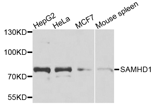 [KO Validated] SAMHD1 Polyclonal Antibody