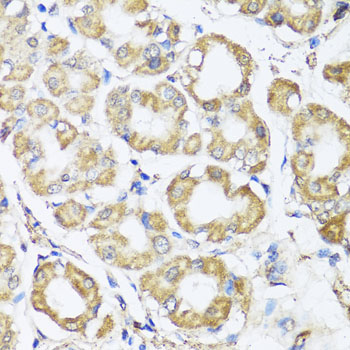 B9D1 Polyclonal Antibody