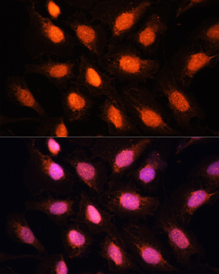 TERF2IP Polyclonal Antibody
