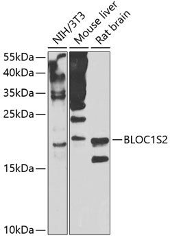 BLOC1S2 Polyclonal Antibody