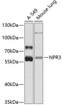 NPR3 Polyclonal Antibody