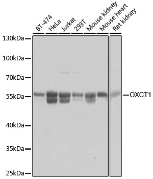 [KO Validated] OXCT1 Polyclonal Antibody