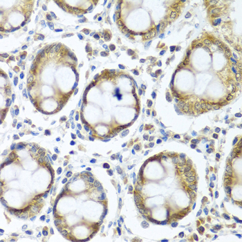 IFI44 Polyclonal Antibody