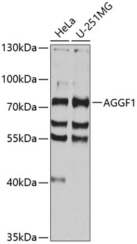 AGGF1 Polyclonal Antibody