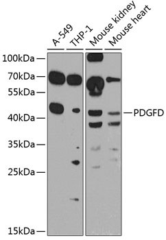 PDGFD Polyclonal Antibody