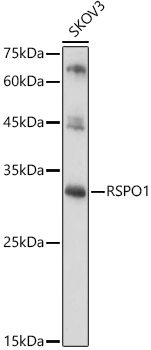 RSPO1 Polyclonal Antibody