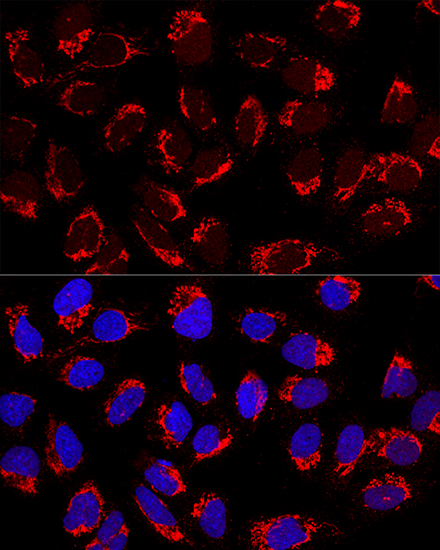 AP1M2 Polyclonal Antibody
