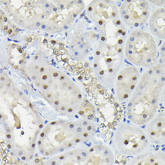 KPNA3 Polyclonal Antibody