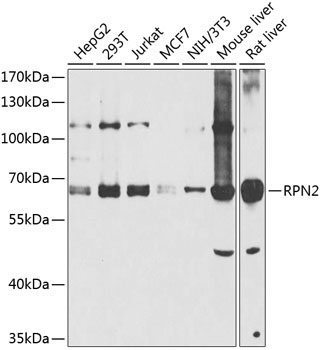 RPN2 Polyclonal Antibody
