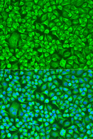 TUBB8 Polyclonal Antibody