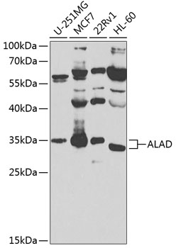 ALAD Polyclonal Antibody