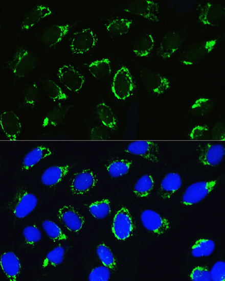 PTCD3 Polyclonal Antibody