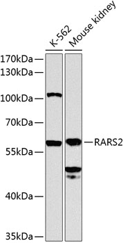 RARS2 Polyclonal Antibody