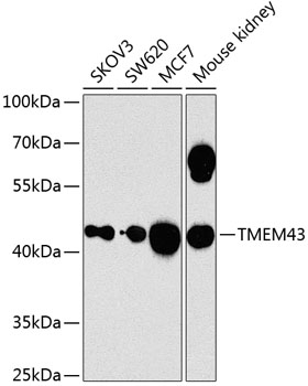 TMEM43 Polyclonal Antibody