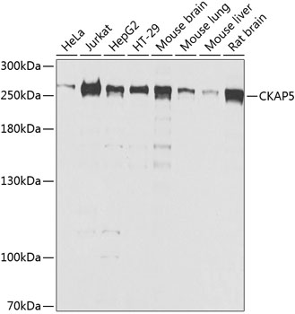 CKAP5 Polyclonal Antibody