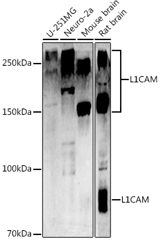 [KO Validated] L1CAM Polyclonal Antibody