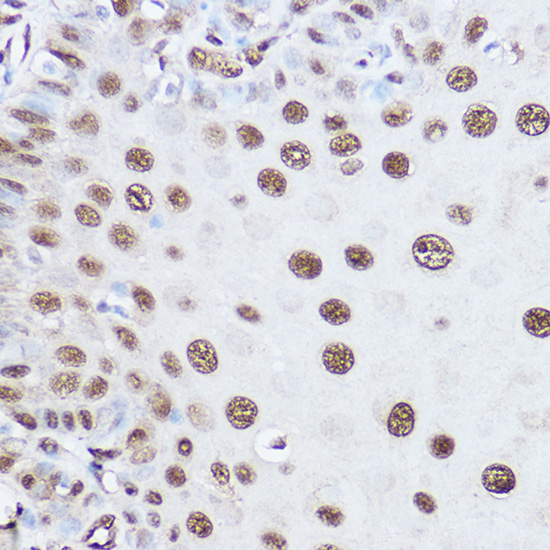 SART1 Polyclonal Antibody