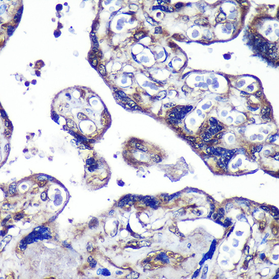 PASK Polyclonal Antibody