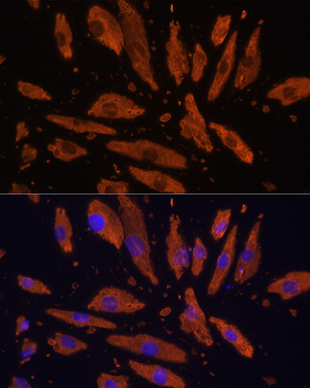 SIRPA Polyclonal Antibody