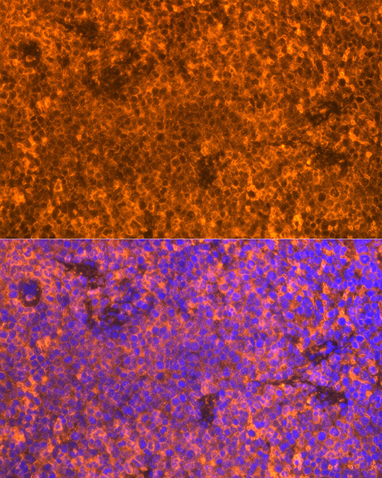 FAM65B Polyclonal Antibody