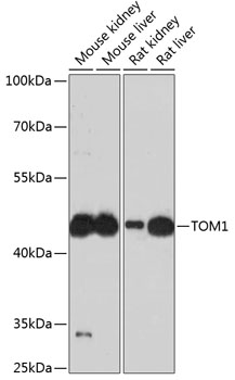 TOM1 Polyclonal Antibody