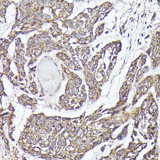 METTL4 Polyclonal Antibody