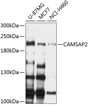 CAMSAP2 Polyclonal Antibody