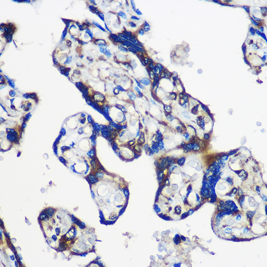EYA1 Polyclonal Antibody